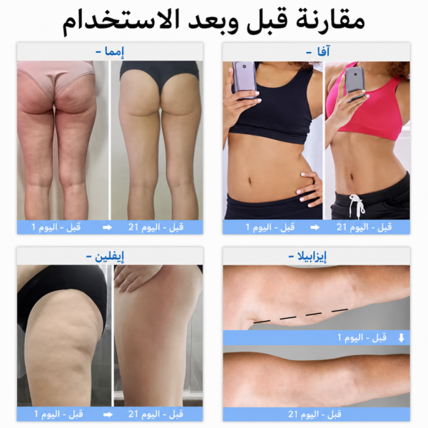 جهاز السليوليت من FELMAR BEAUTY